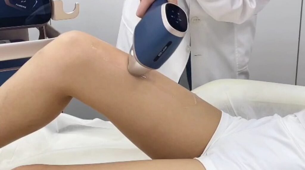 diode laser hair removal treatment with medical ce certified laser hair removal system