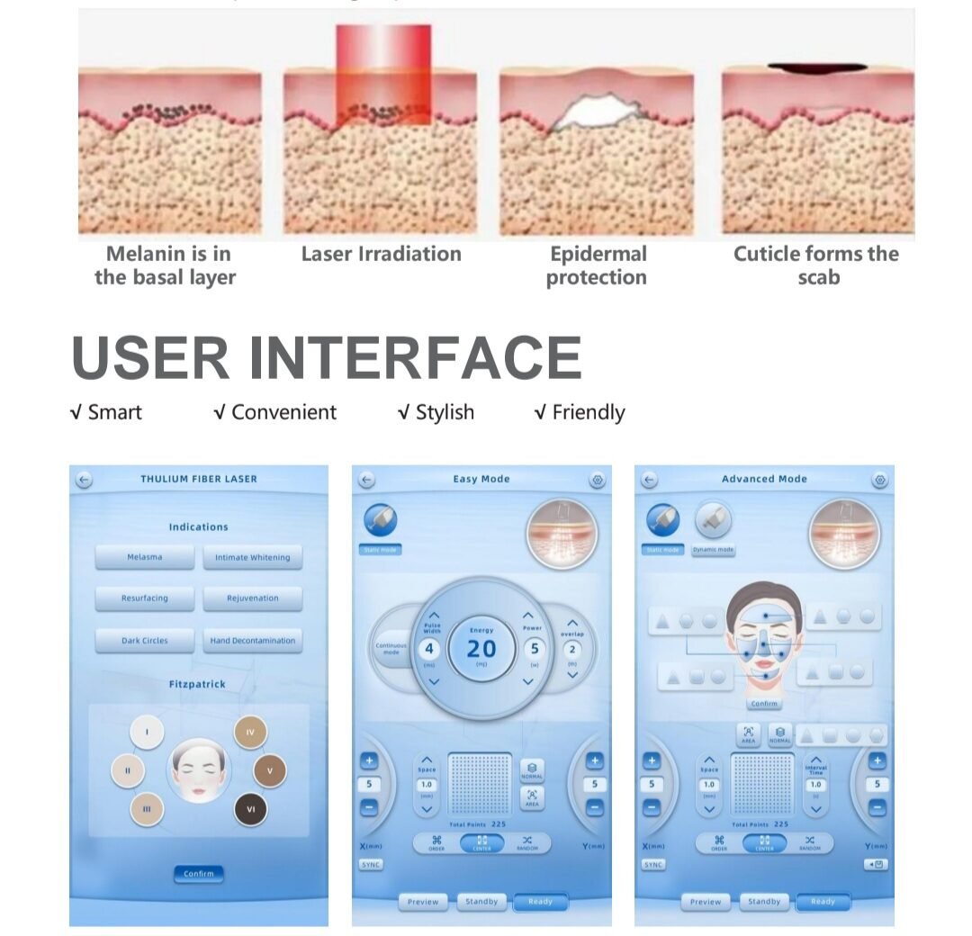 Sinako Medical FDA Approved 1927nm fractional thulium laser