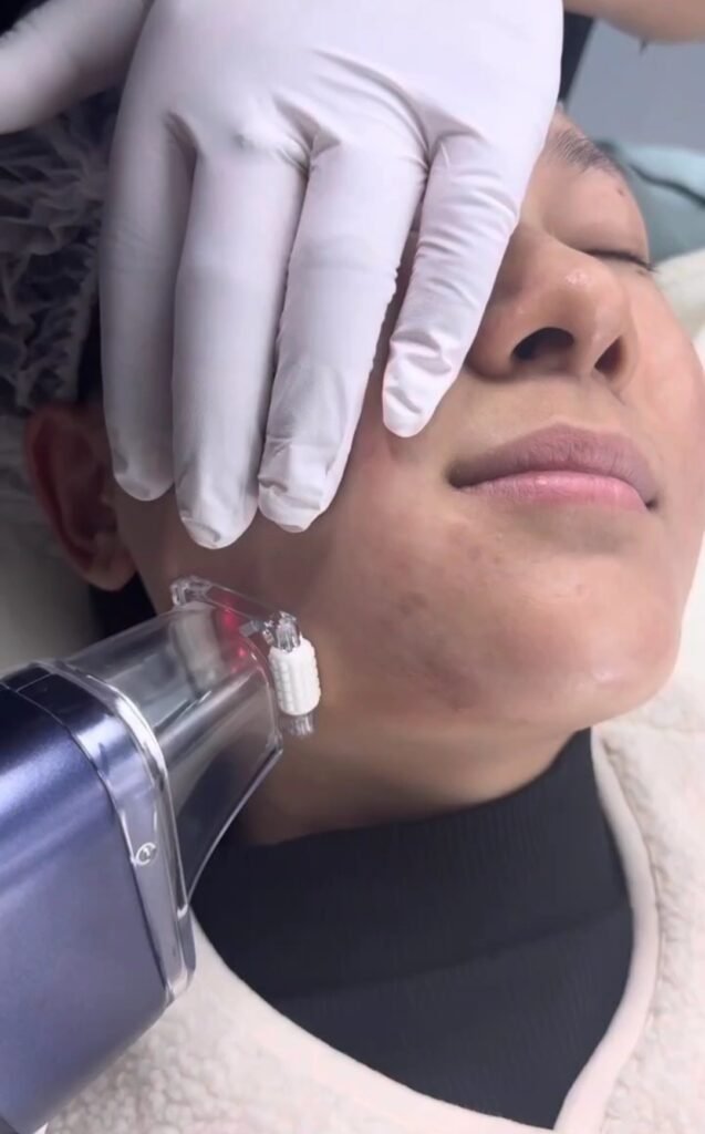 long term result aesthetics equipment