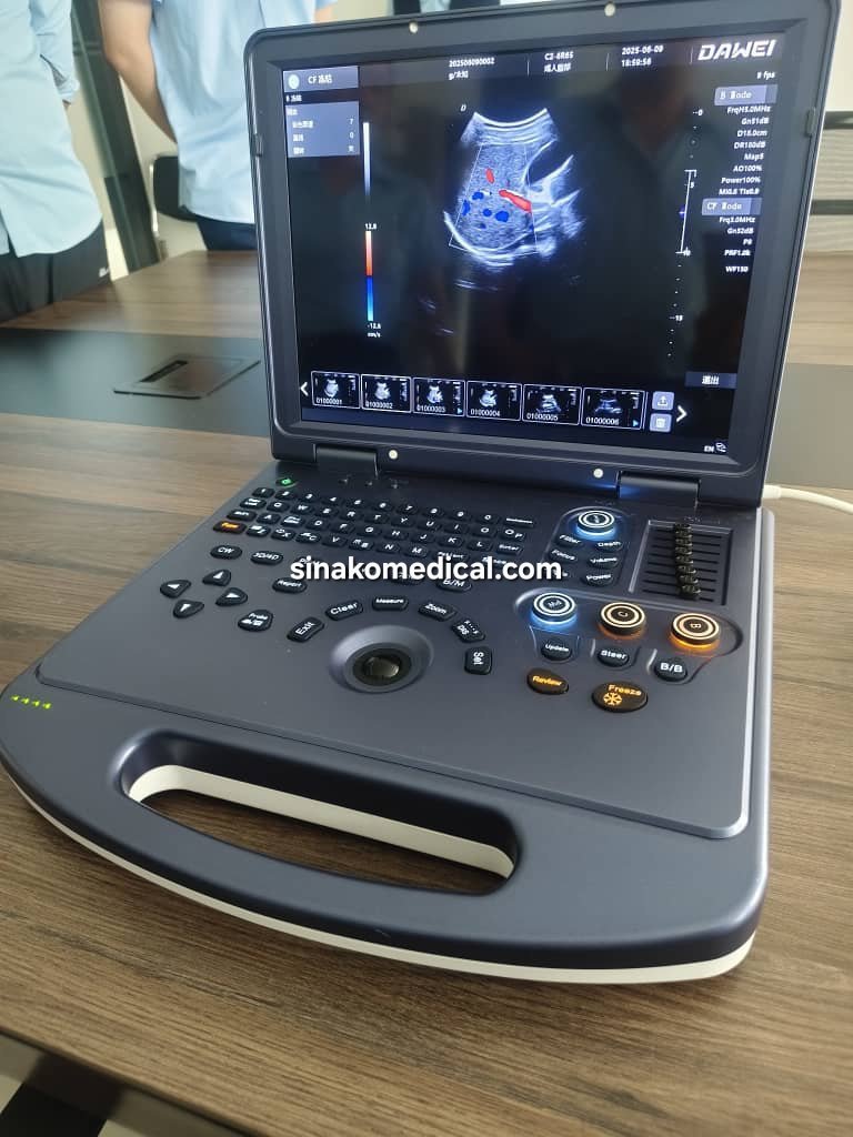 Dawei DW-L3i Laptop Diagnostic Ultrasound Machine