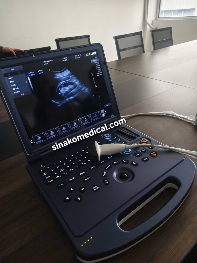 Sinako Medical Supplies Ultrasound systems