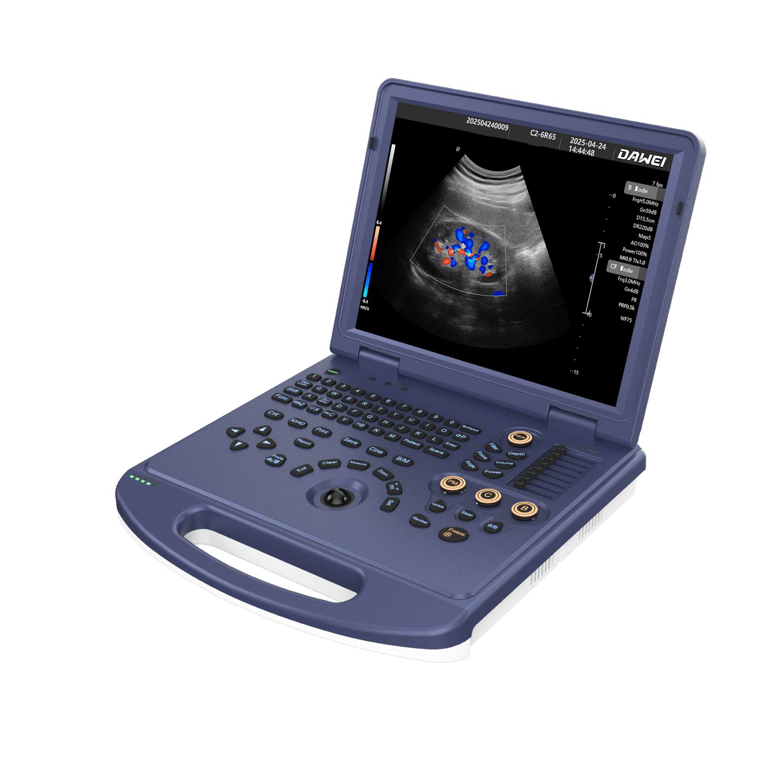 Dawei DW-L3i portable ultrasound scanner supplied by Sinako Medical in South Africa.