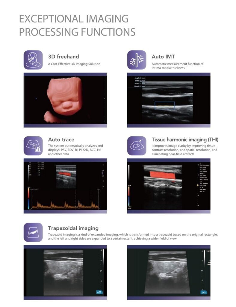 Color Doppler ultrasound machine for obstetrics, gynecology, and vascular examinations