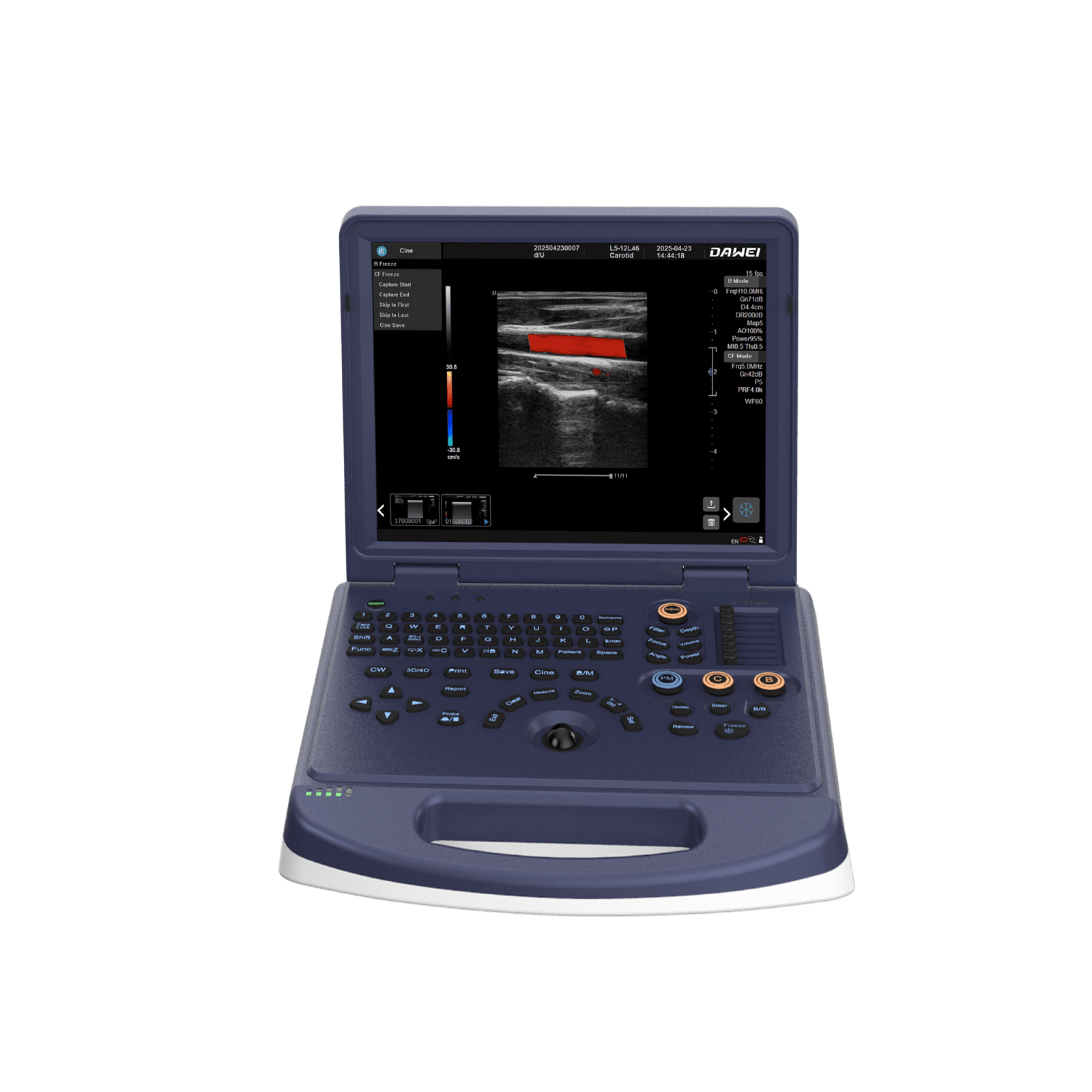 Dawei DW-L3i laptop diagnostic ultrasound machine with 15-inch HD display, available from Sinako Medical.