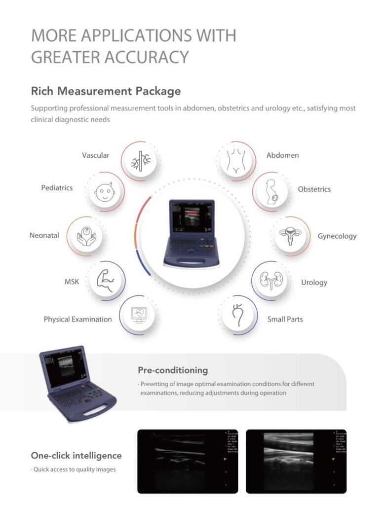High-definition digital ultrasound scanner with tissue harmonic imaging for clear results.
