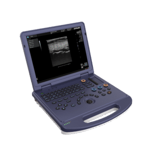Portable color Doppler ultrasound machine for hospitals and clinics, lightweight laptop design