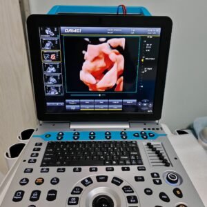 Portable Color Doppler Ultrasound System