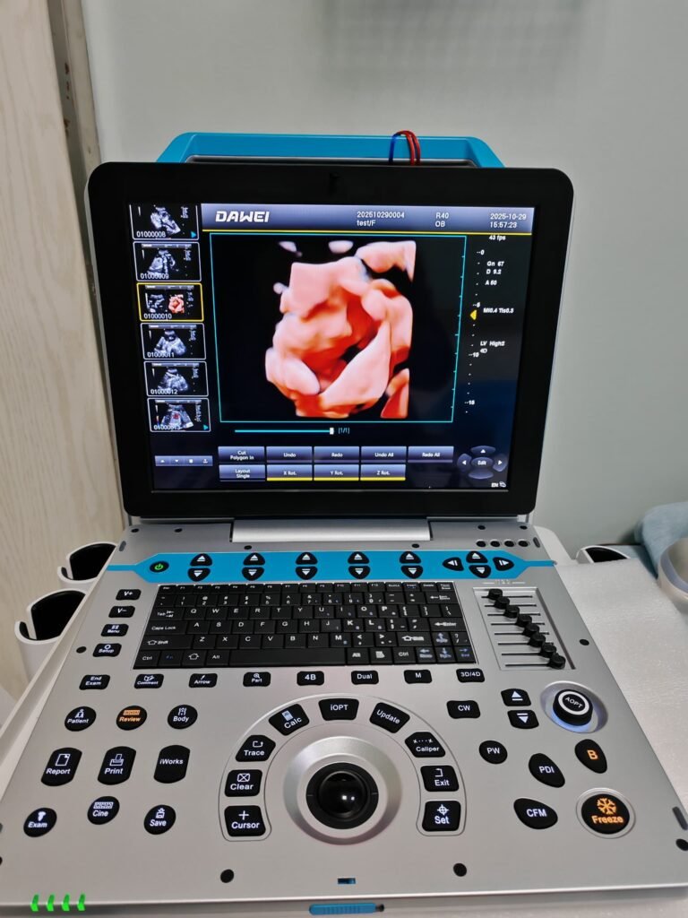 Portable Color Doppler Ultrasound System