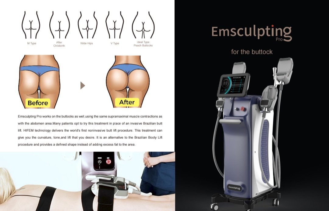 Medical aesthetic muscle sculpting machine for clinics offering non-invasive body shaping