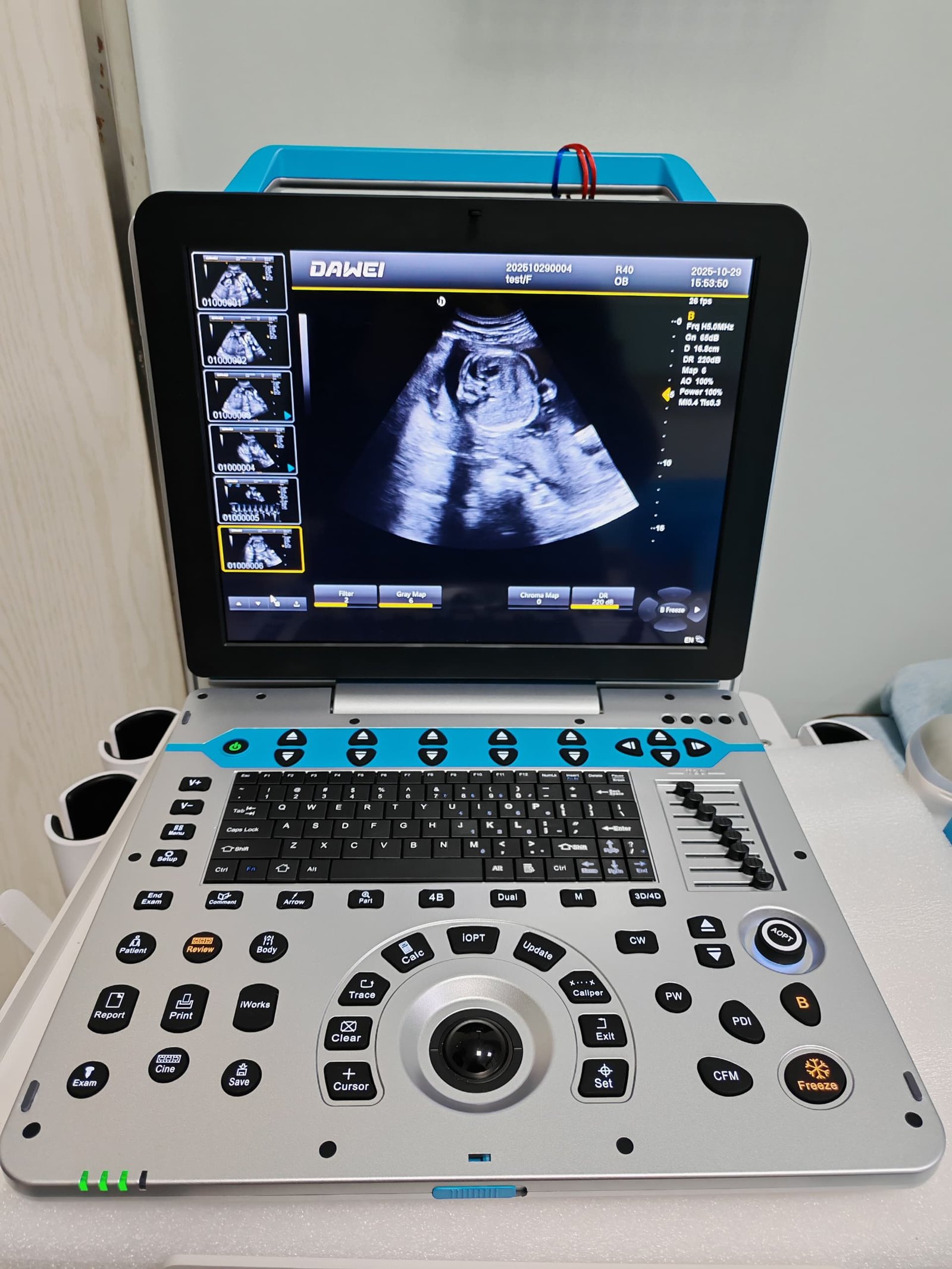 trapezoidal imaging technology on portable ultrasound system