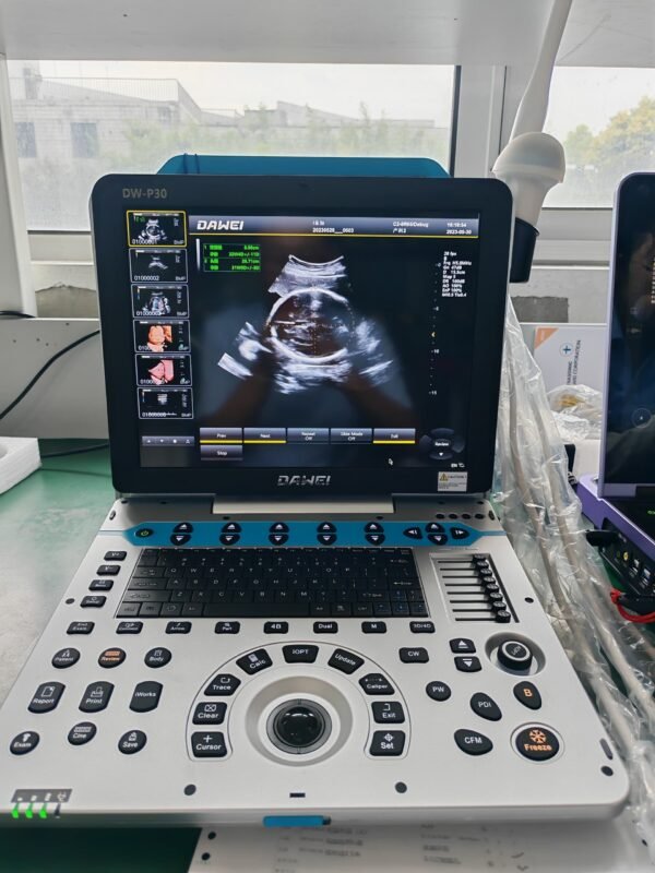 DW-P30 Portable Color Doppler Ultrasound System | 3D 4D 5D Real Skin ...