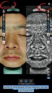 AI skin Analysis machine with moist detector
