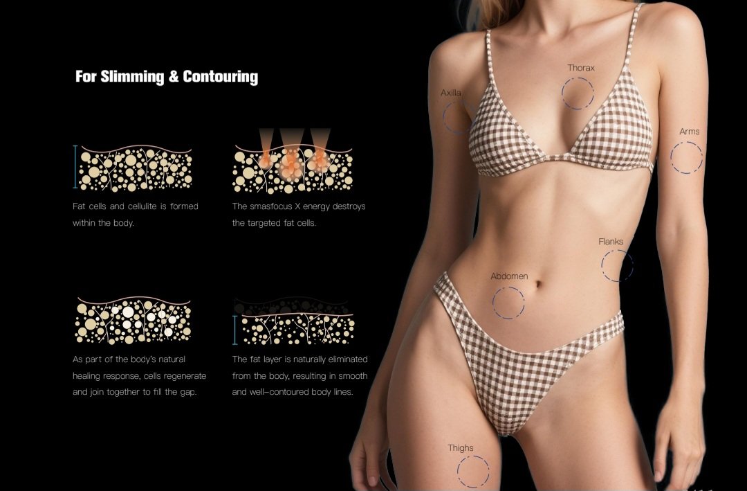 Hifu facelift and body contouring machine