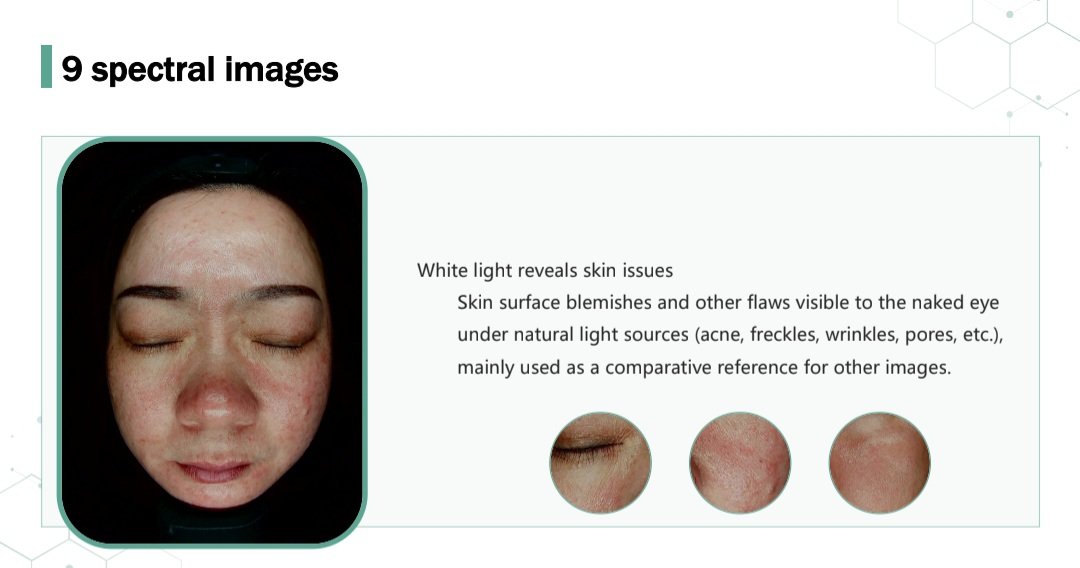 DermaInsightPro AI Skin Analyzer Machine for professional skin analysis