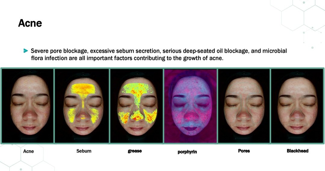 Professional skin analysis machine for facial skin analysis and assessment