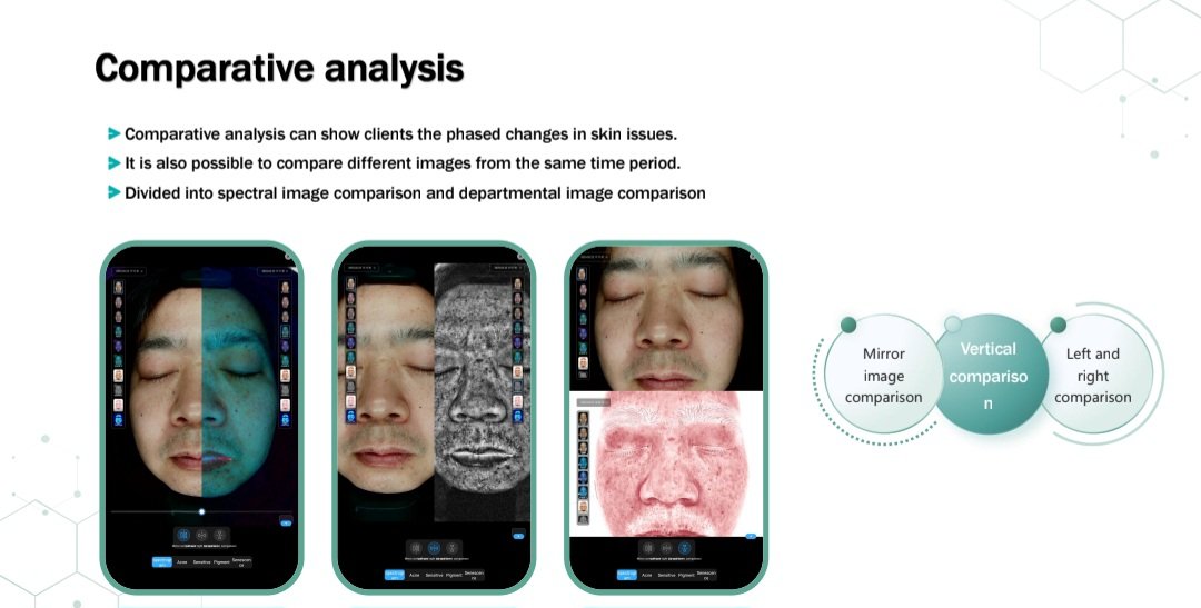 AI skin analysis machine showing before and after skin comparison
