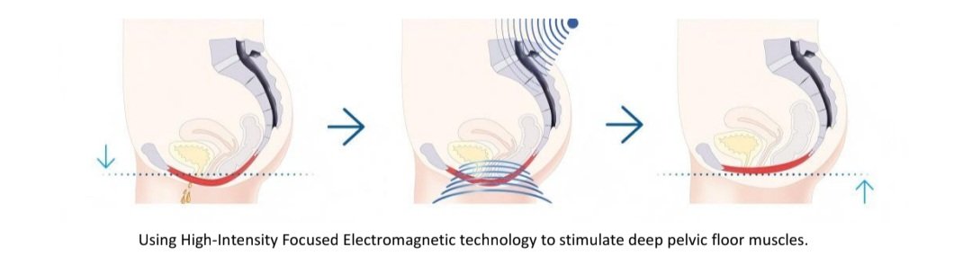 Glutes conditioning wellness ems chair