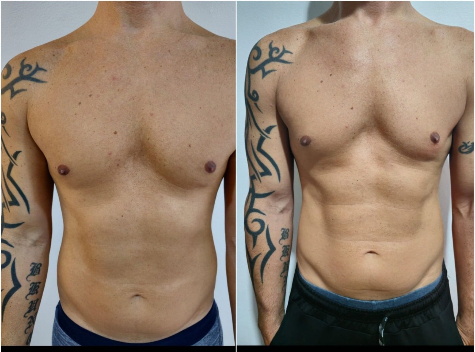 body sculpting machine for men