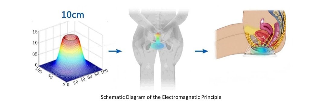 Post patrum Pelvic floor restoration machine