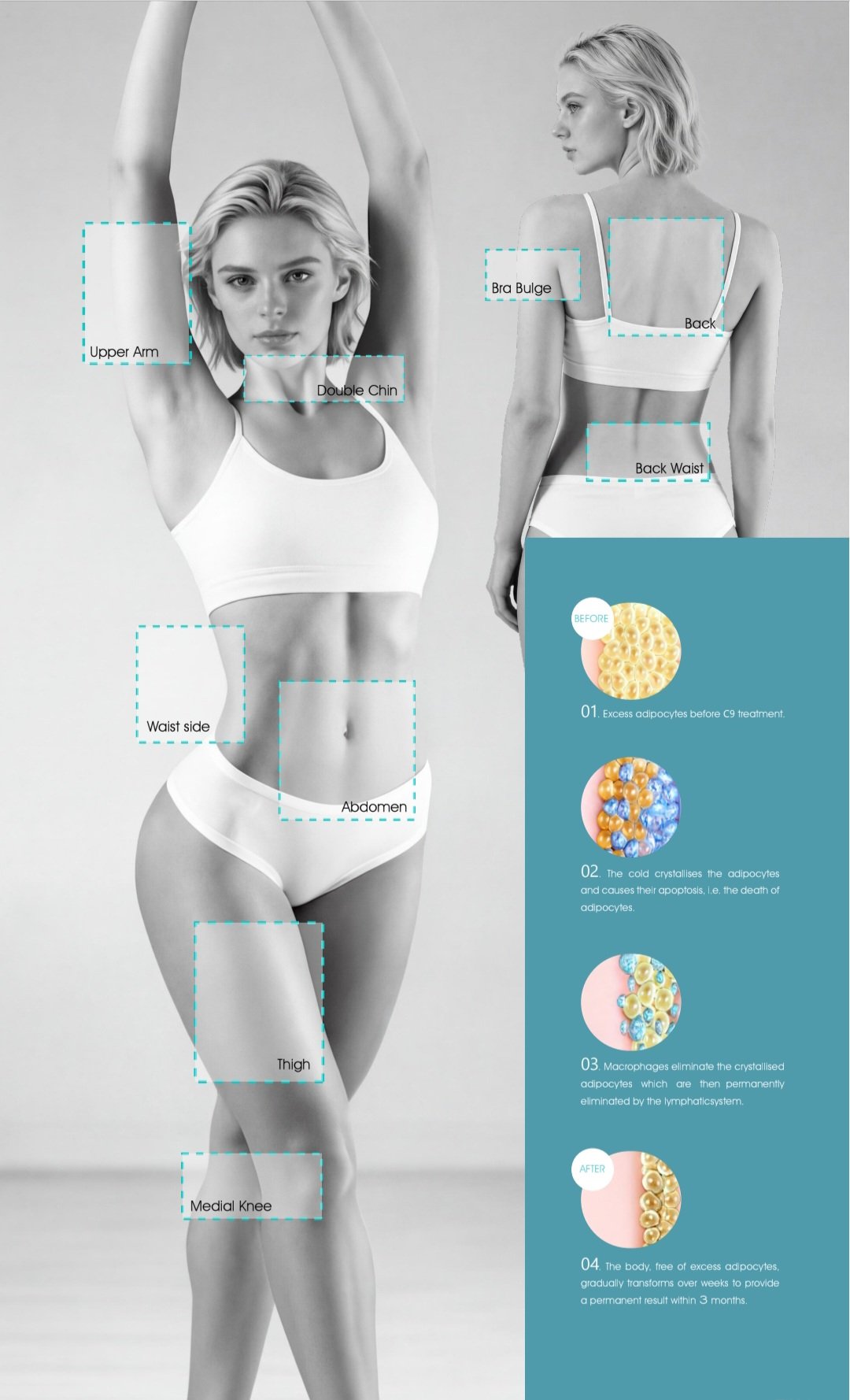 Cryo TEC Pro professional aesthetic body contouring equipment for international clinics