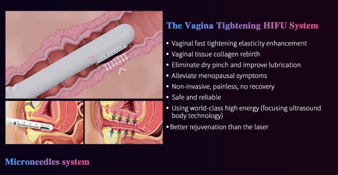 Hif u with Vaginal tightening machine