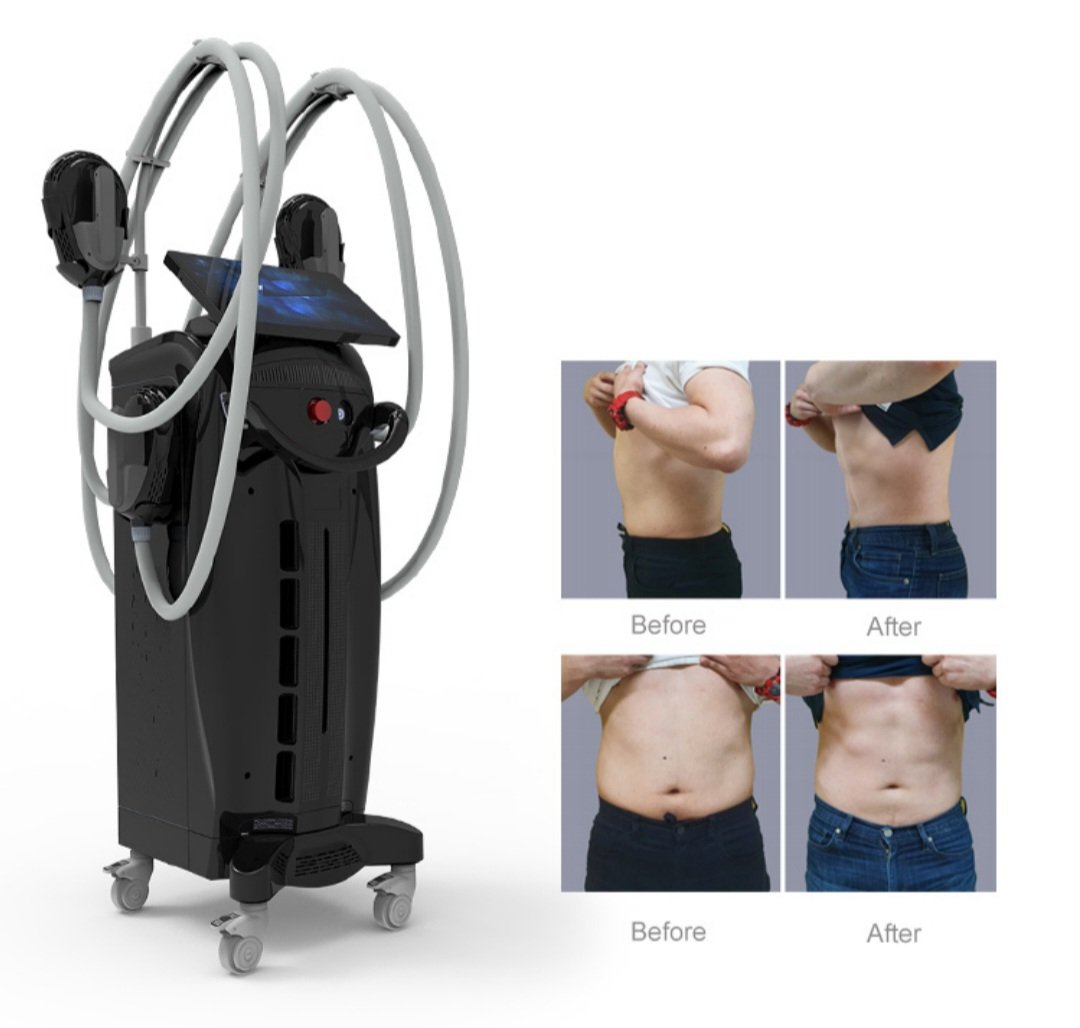 Professional EMS machine for abdominal muscle stimulation